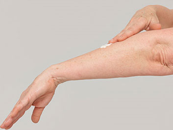 Shingles Cream Treatment